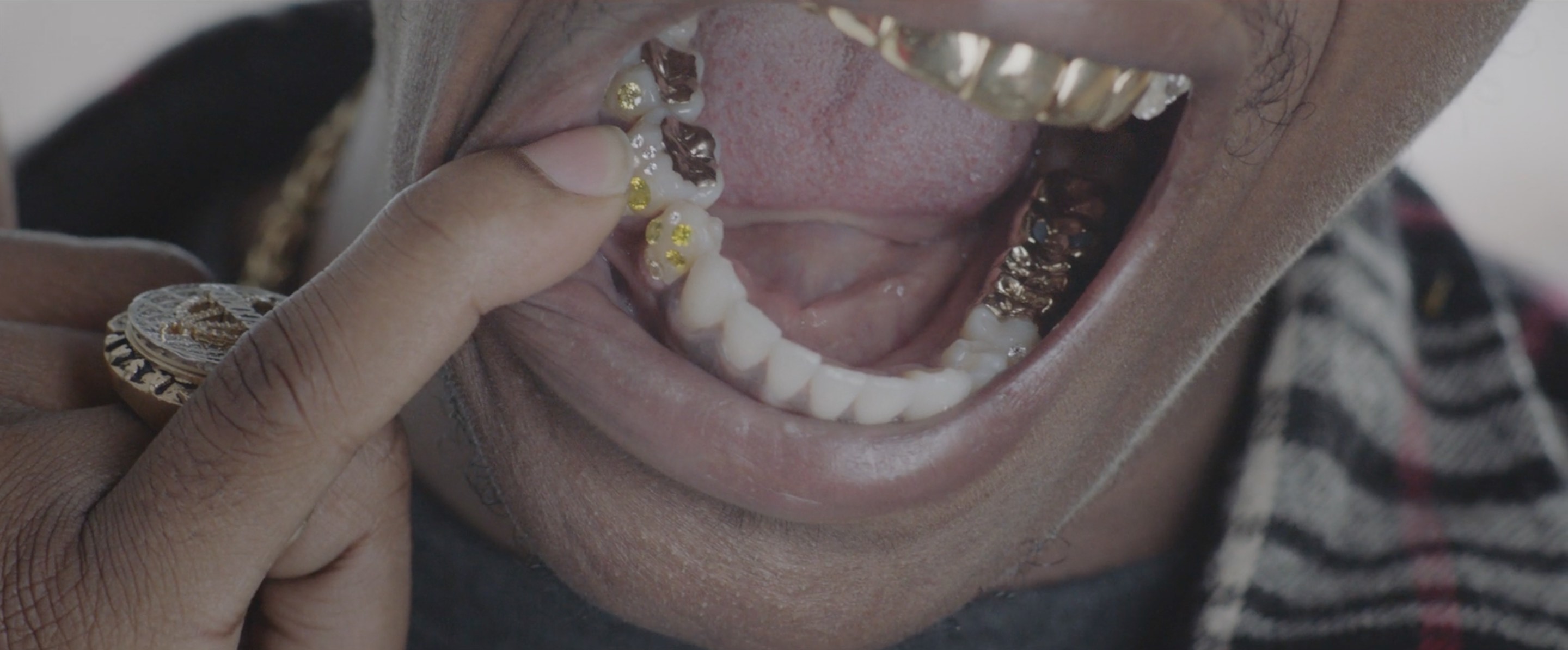 Mouth Full Of Golds – Documentary